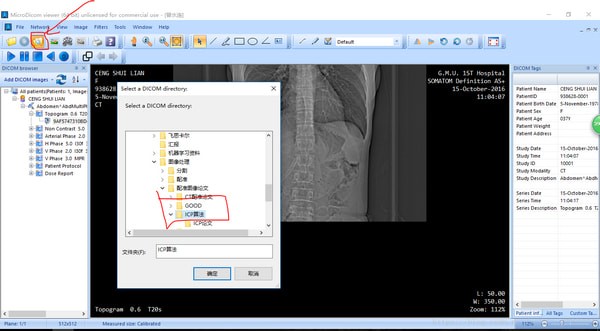 MicroDicom  viewer(Dicom格式看图软件)