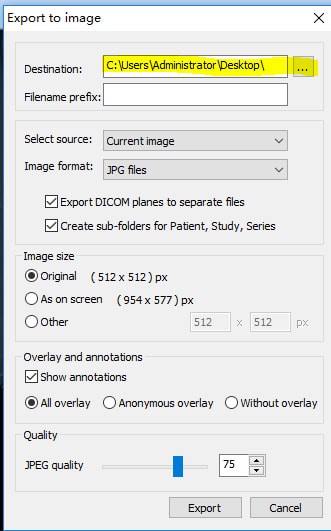 MicroDicom  viewer(Dicom格式看图软件)