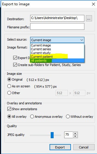 MicroDicom  viewer(Dicom格式看图软件)