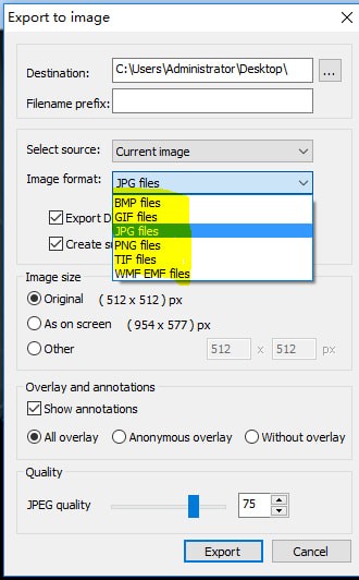 MicroDicom  viewer(Dicom格式看图软件)