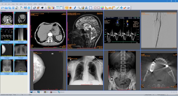 Sante  DICOM  Editor(DICOM编辑器)