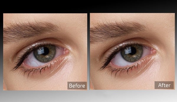 Retouch4me  Eye  Vessels(图片处理工具)